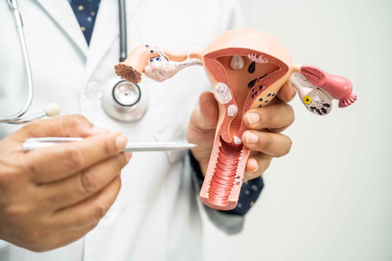 Female Infertility Treatment by Dr Bhagyashri Naphade