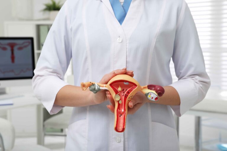 PCOD and PCOS Treatment by Dr Bhagyashri Naphade